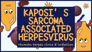 Kaposi Sarcoma Associated Herpes virus HHV 8 Morphology Diagnosis Treatment amp Prevention [upl. by Enyrehtac87]