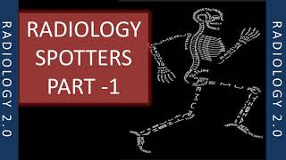 RADIOLOGY SPOTTERS RADIOLOGY 20 PART 1 XRAY [upl. by Bidget]