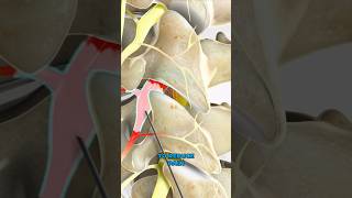 Selective nerve root block 3D Animation [upl. by Tnilk952]