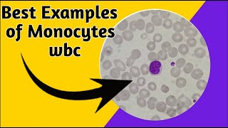 How to identify monocytes in microscope I morphology of wbc [upl. by Veal]