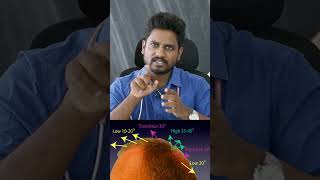 hairtransplanttamil hairfallsolution hairtransplantincoimbatore hairtransplanttamilnadu [upl. by Adonis]