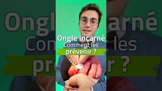 Ongle incarné  conseils de prévention et traitement [upl. by Laud350]