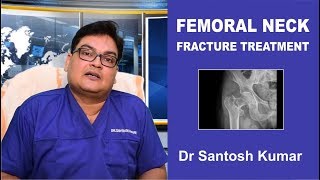 Femoral Neck Fracture Treatment Hip Fracture Treatment By Dr Santoshkumar Kolkata India [upl. by Yeniffit53]