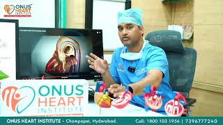 Revolutionizing Heart Valve Care Dr Lakkireddy on Advanced TAVI Procedure at Onus Heart Institute [upl. by Crispa]