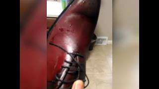 Chaussures trop serrées  astuce [upl. by Irehs]