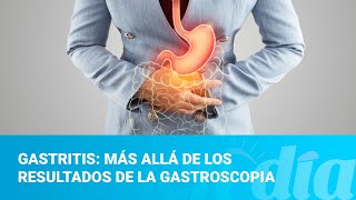 Gastritis más allá de los resultados de la gastroscopia [upl. by Ras]