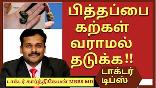 gallbladder stones treatment in tamil  pitha pai kal  பித்தப்பை கற்கள்  dr karthikeyan tamil [upl. by Aroved]