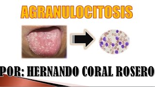 AGRANULOCITOSIS  INSUFICIENCIA DE NEUTROFILOS [upl. by Tarton305]