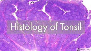 Histology of Tonsil [upl. by Gonyea]