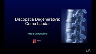 DISCOPATIA DEGENERATIVA COMO LAUDAR [upl. by Kier]