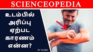 Why Do We Itch  Explained in Tamil  Scienceopedia [upl. by Carlson]