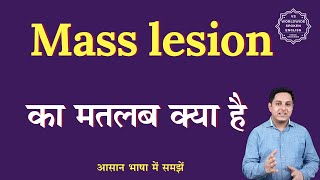 Mass lesion meaning in Hindi  Mass lesion ka matlab kya hota hai  English to hindi [upl. by Nasaj]