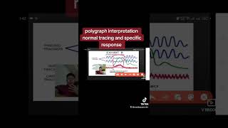 Polygraph reading and interpretation Normal Tracing and Specific response [upl. by Ecirbaf]