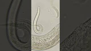 Phylum Aschelminthes Nematoda Roundworms [upl. by Brit766]