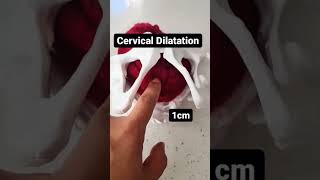 How the cervix dilated Cervical dilation in 20 seconds [upl. by Rizika142]