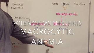 Macrocytic Anemia Easily Explained [upl. by Ioves]