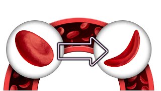 Como Bajar la Hemoglobina Glicosilada el Azúcar en 3 meses [upl. by Sible]