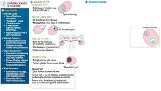 Ovarian cysts and tumors [upl. by Aniarrol300]