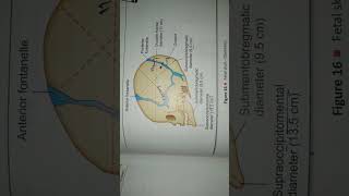Fetal skull amp Diameters [upl. by Niwre]