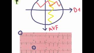 Calcul de laxe du coeur avec la méthode des quadrants [upl. by Akessej456]