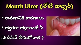 Mouth Ulcers Reasons and Treatment in Telugu [upl. by Yelyac601]