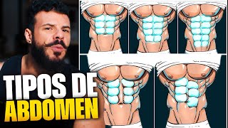 POR QUE OS ABDOMENS SÃO DIFERENTES [upl. by Thayne]