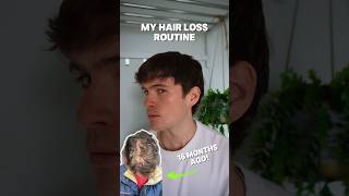 HOW TO STOP HAIR LOSS my routine hairloss shorts [upl. by Guyer241]