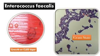 Enterococcus faecalis Colony Morphology and Gram Staining [upl. by Orv]