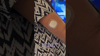 Testing the Medtronic Simplera CGM t1d diabetes [upl. by Mirielle180]