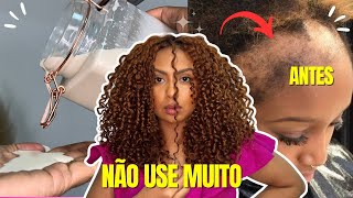 O CABELO CRESCE EM 10 DIAS COM APENAS 2 INGREDIENTES COMBATE A QUEDA CAPILAR [upl. by Alpheus]