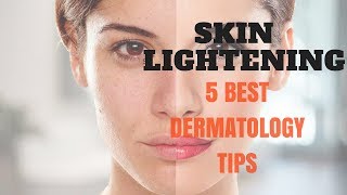 SKIN LIGHTENING 5 Best Dermatology Tips [upl. by Hernandez594]