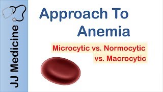 Anemia  Microcytic vs Normocytic vs Macrocytic [upl. by Ilak]