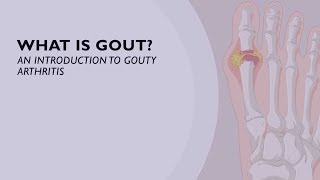 What is Gout An Introduction to Gouty Arthritis 1 of 6 [upl. by Astiram]