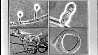 Nematophagous fungi part 1 [upl. by Anele]