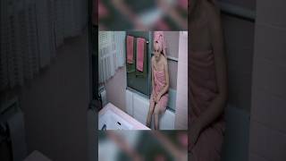 Strange Girl With Teeth In Private Parts shorts viral [upl. by Ylatfen]