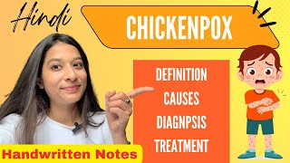 Chickenpox Explained in Hindi  Causes Signs amp Symptoms Diagnosis amp Treatment [upl. by Anilat]