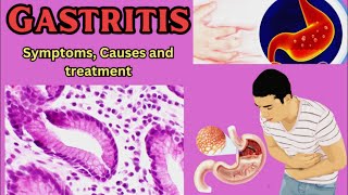 Gastritis Symptoms Causes and Treatment [upl. by Darla]