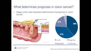 Colon and Rectal Cancer How much of a problem is it really [upl. by Nassi]