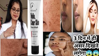 Woodoo Hello Clear Skin Face Wash Honest ReviewHello clear skin face wash usesampside effects review [upl. by Naarah]