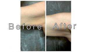 Tighten Flabby Arms amp Remove Stretch Marks [upl. by Inigo]