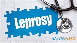 Leprosy ¦ Treatment and Symptoms [upl. by Bellis]