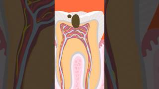 Root Canal Treatmentrct [upl. by Airdni217]