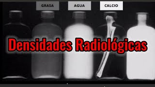 Las 5 Densidades Radiológicas Básicas Explicadas ☢✅ [upl. by Nidak303]