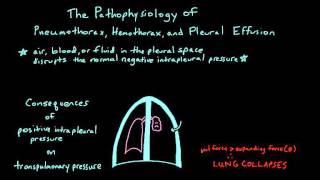 The Fundamentals of Chest Tube Physiology for Learners on a Surgery Rotation [upl. by Yerahcaz]