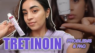 Tretinoin Troubleshooting FAQs for Common Concerns [upl. by Kari]