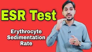 ESR Test  Erythrocyte Sedimentation Rate  High ESR Causes [upl. by Sacha323]