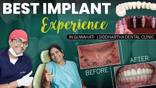 Get the best Implant Experience in Guwahati Assam Get back your beautiful smile [upl. by Karalee]