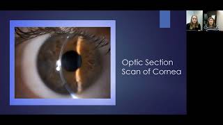 Lecture Using the Slit Lamp Microscope to Visualize the Ocular Structures [upl. by Bridgette]