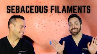 Black Dots on the Nose Heres How To Treat Sebaceous Filaments [upl. by Lemmy]