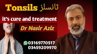 Tonsillitis and its treatment Homeopathic DrNasir Aziz Consult us before operation [upl. by Narmis264]